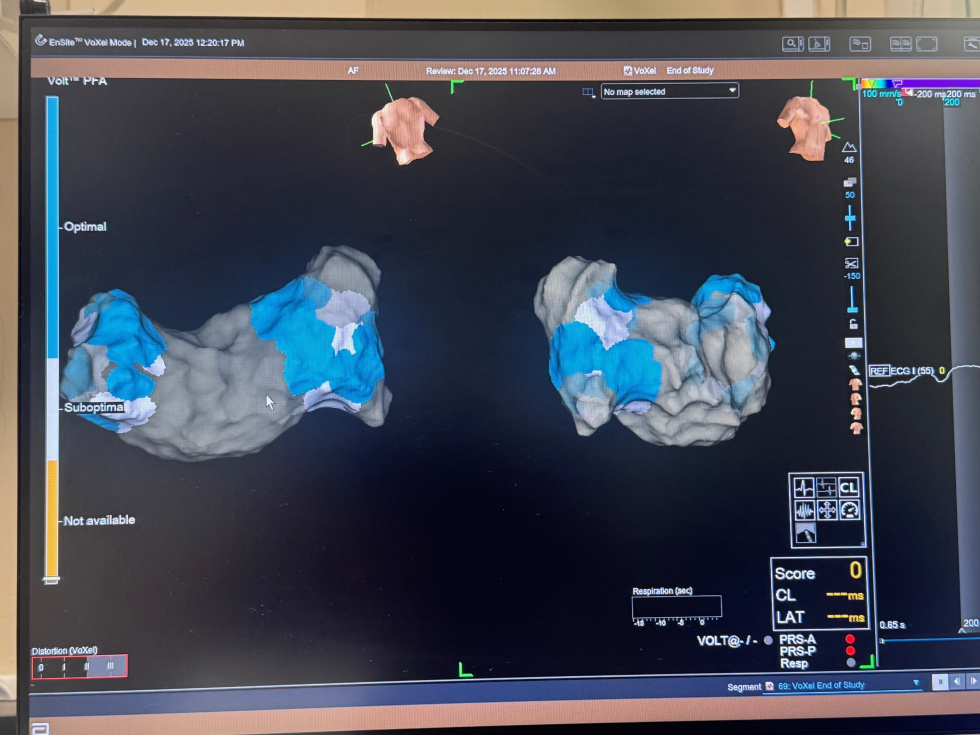 Na zdjęciu cyfrowy obraz serca