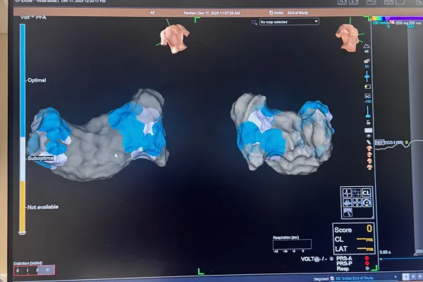 Na zdjęciu cyfrowy obraz serca